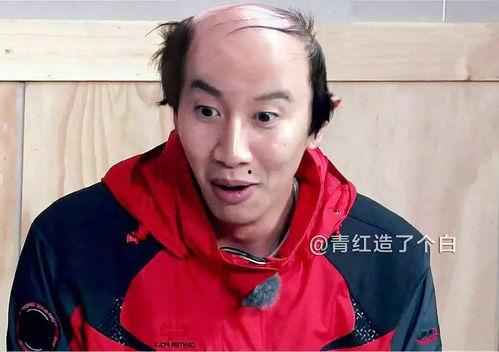 秃头的明星网红叫什么,揭秘网红“秃头明星”的独特风采
